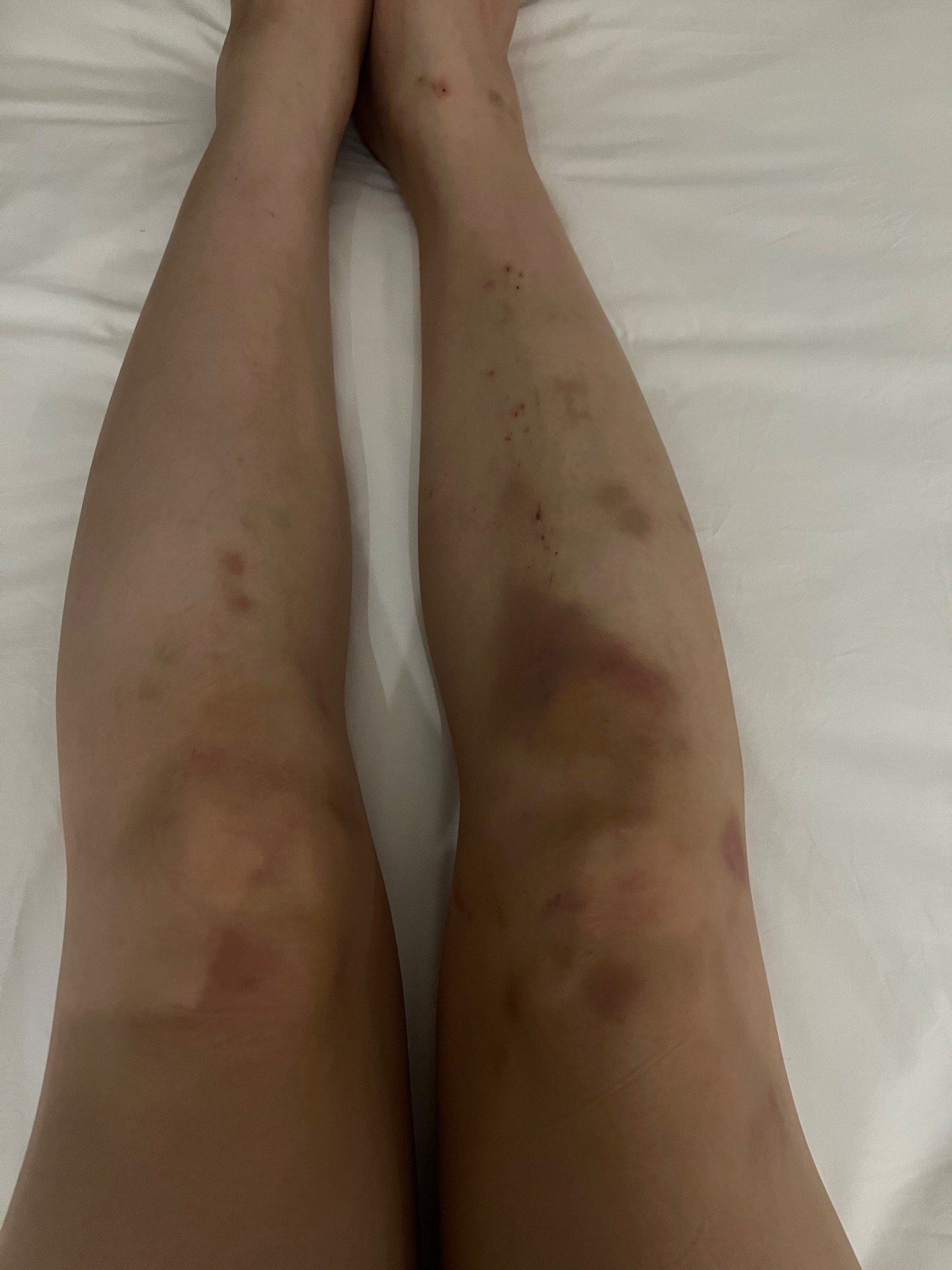 Thighs during training camp